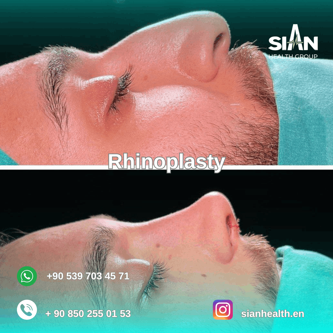 Sian Health