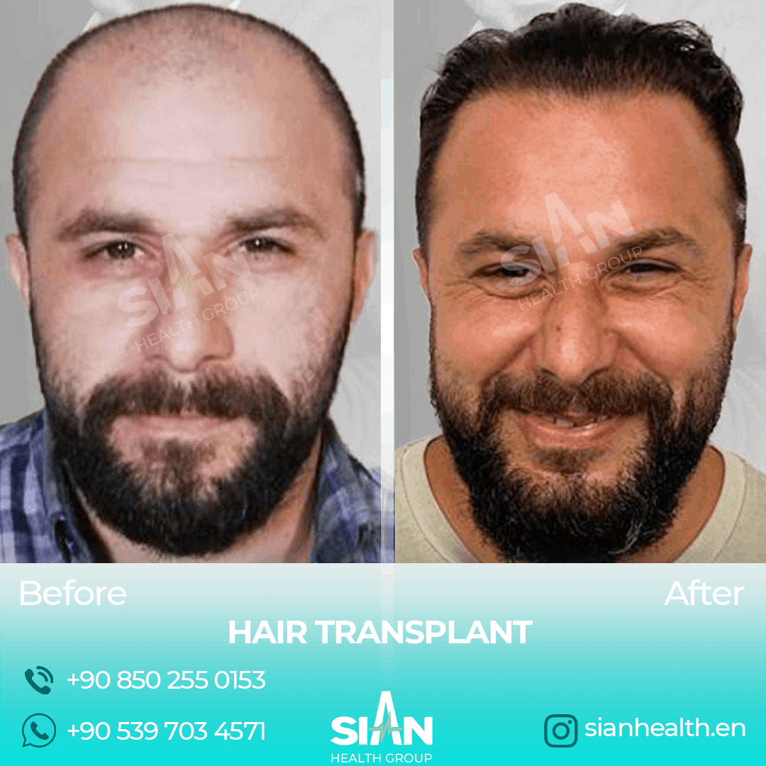 Sian Health