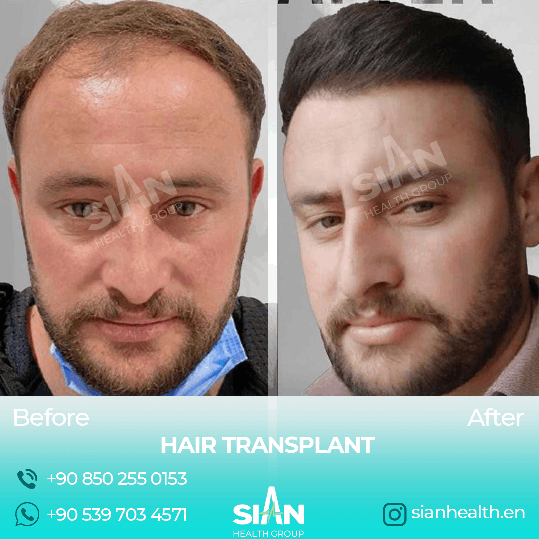 Sian Health
