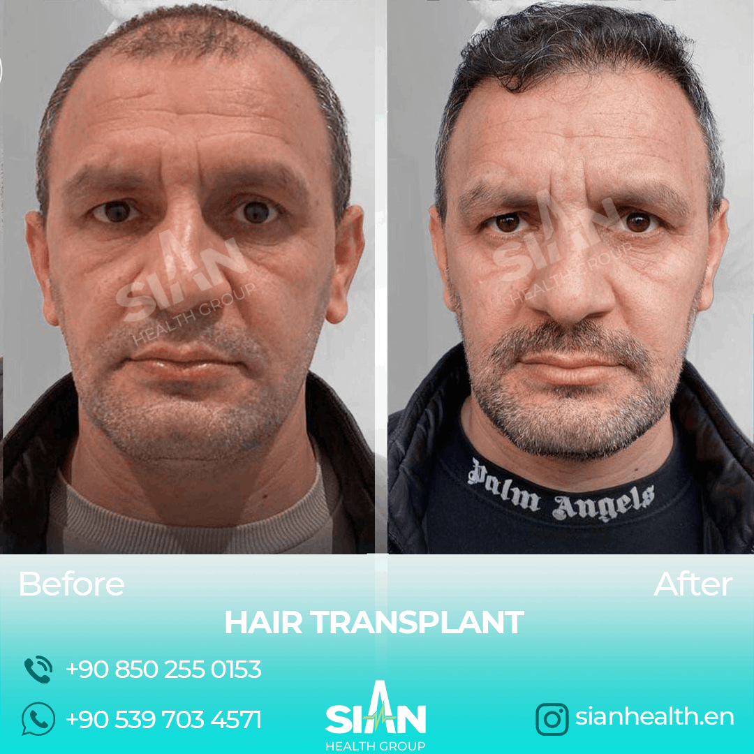 Sian Health