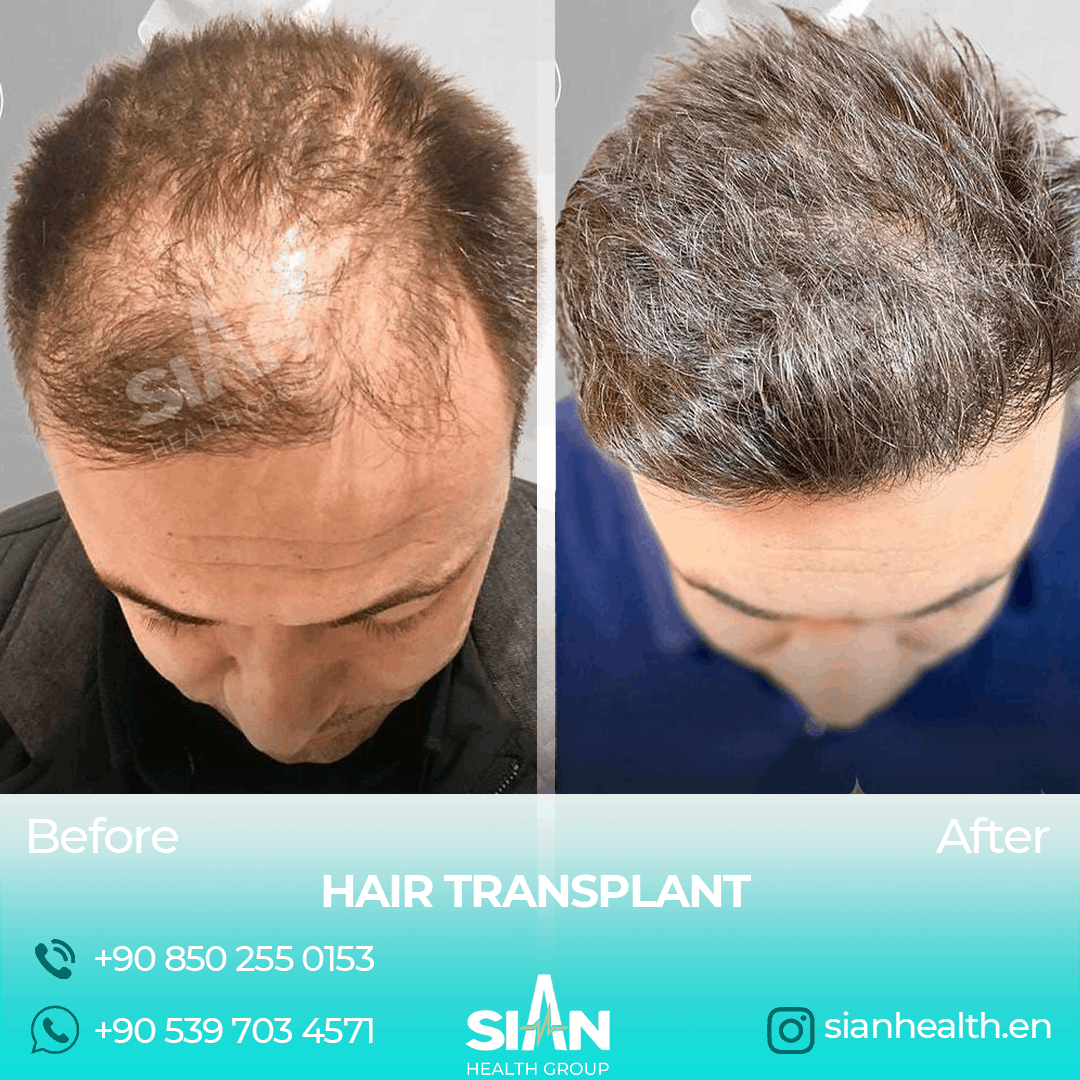 Sian Health