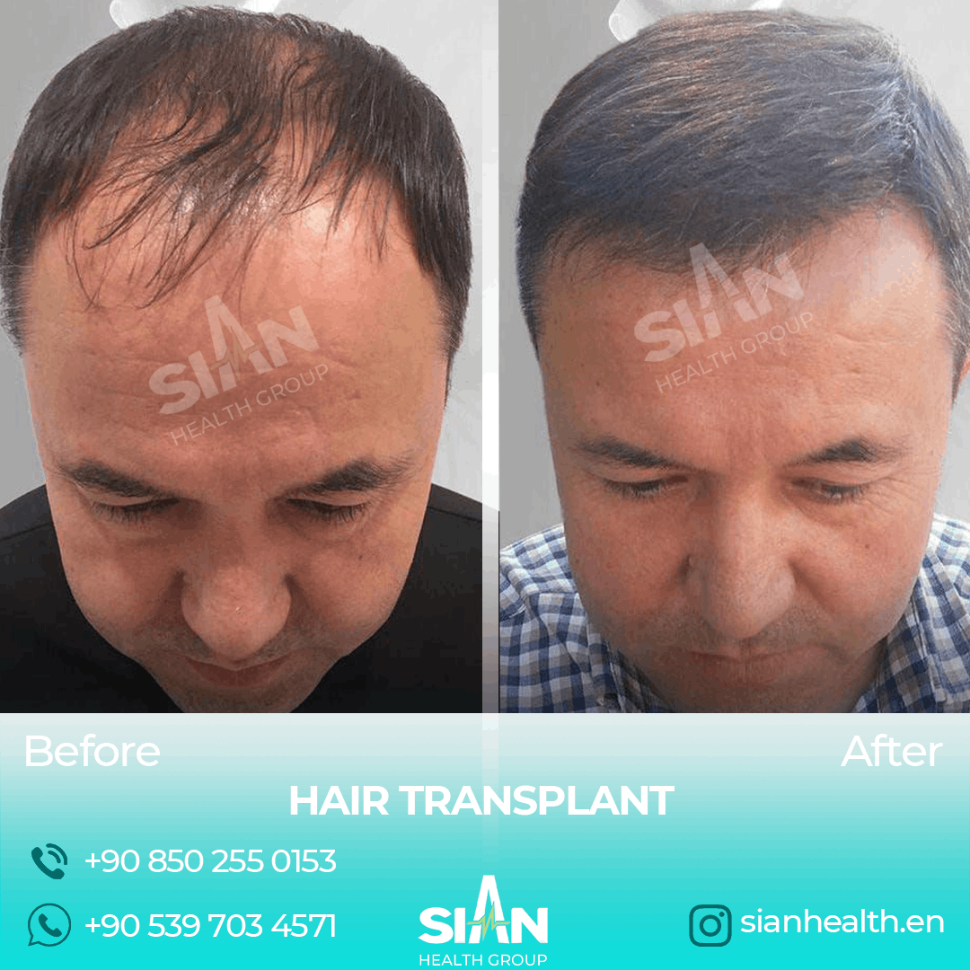 Sian Health